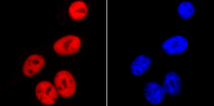 SMC3 Rabbit mAb