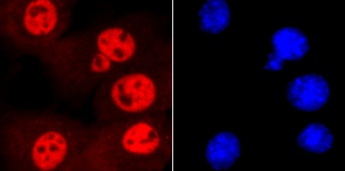 SMC3 Rabbit mAb