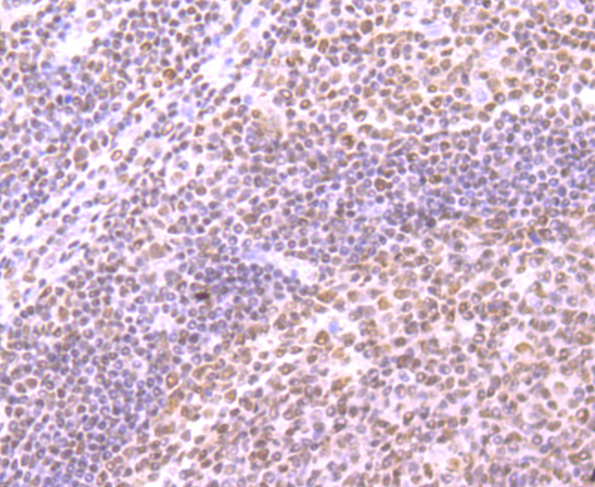 SMC3 Rabbit mAb