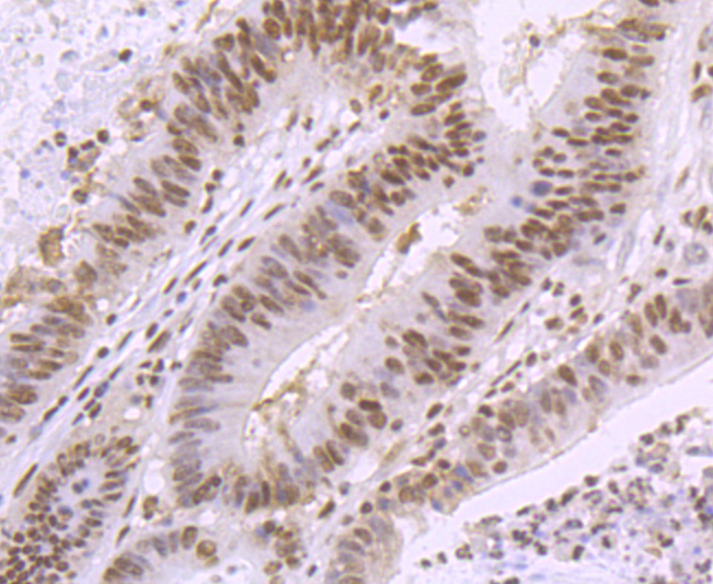 SMC3 Rabbit mAb