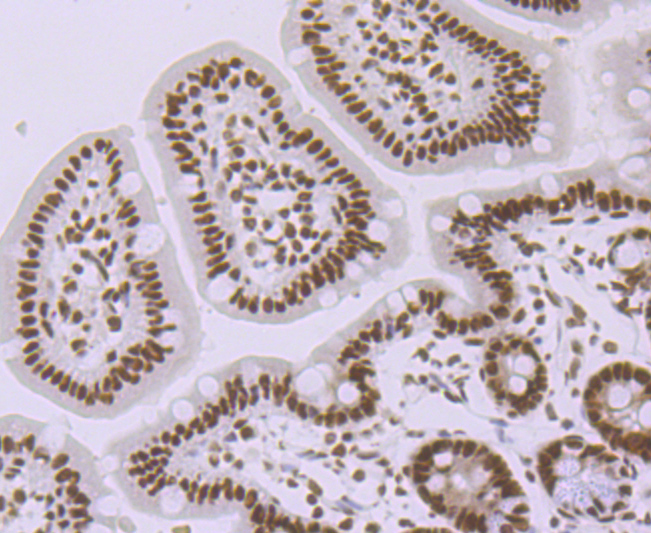 SMC3 Rabbit mAb