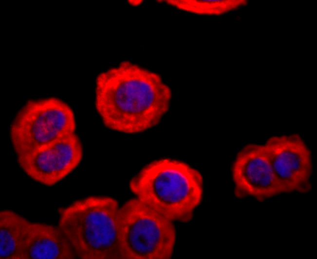 FGFR3 Rabbit mAb