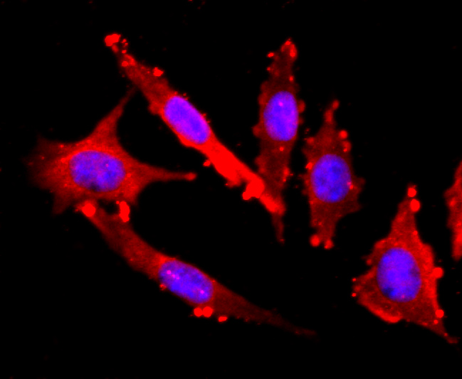 FGFR3 Rabbit mAb