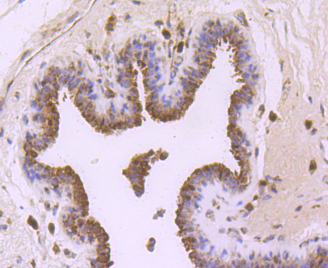 FGFR3 Rabbit mAb