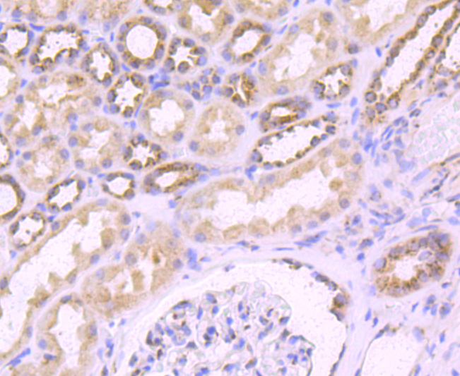 FGFR3 Rabbit mAb