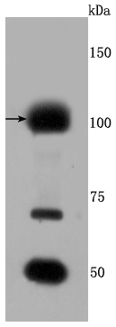 FGFR3 Rabbit mAb