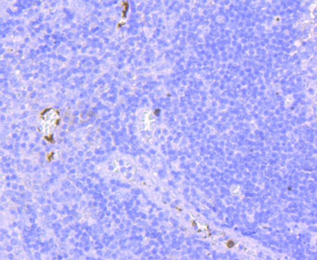 CD41 Rabbit mAb