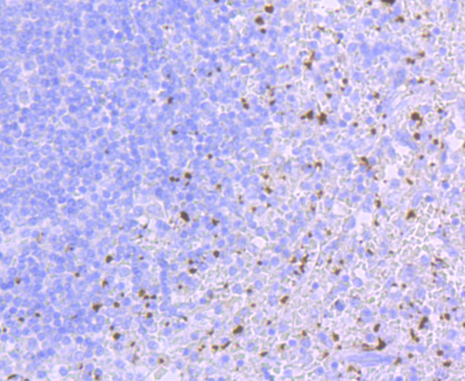 CD41 Rabbit mAb