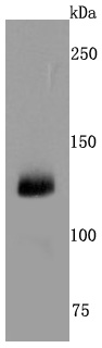 CD41 Rabbit mAb