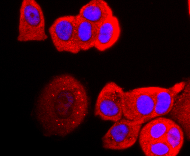 Perilipin A Rabbit mAb