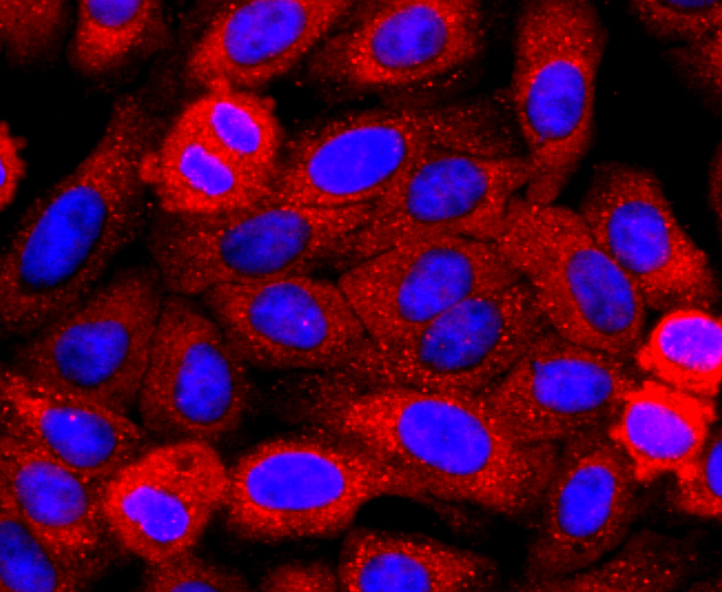 Perilipin A Rabbit mAb