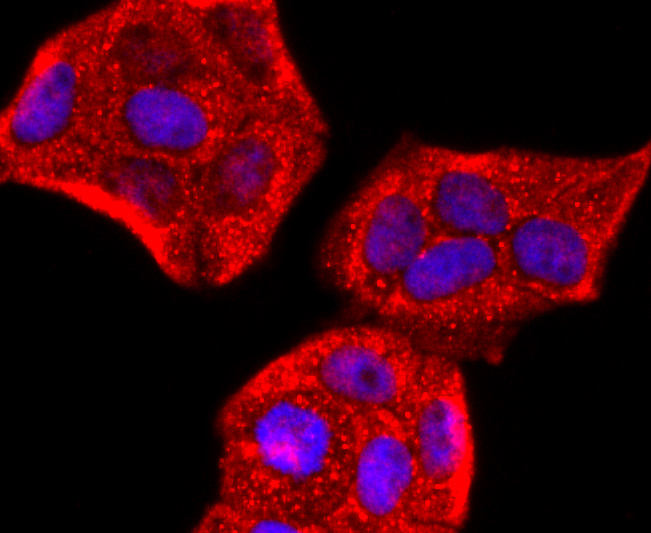 Perilipin A Rabbit mAb