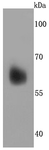 Perilipin A Rabbit mAb