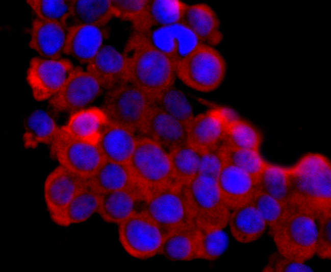 Lipocalin-2 Rabbit mAb