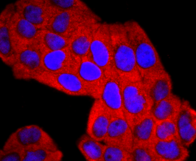 Lipocalin-2 Rabbit mAb