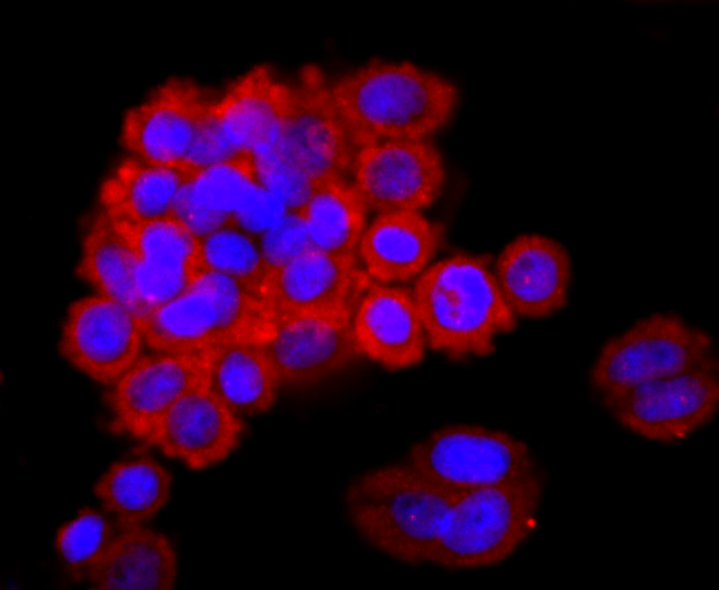 Lipocalin-2 Rabbit mAb