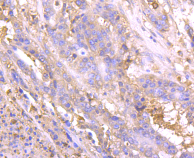 Lipocalin-2 Rabbit mAb