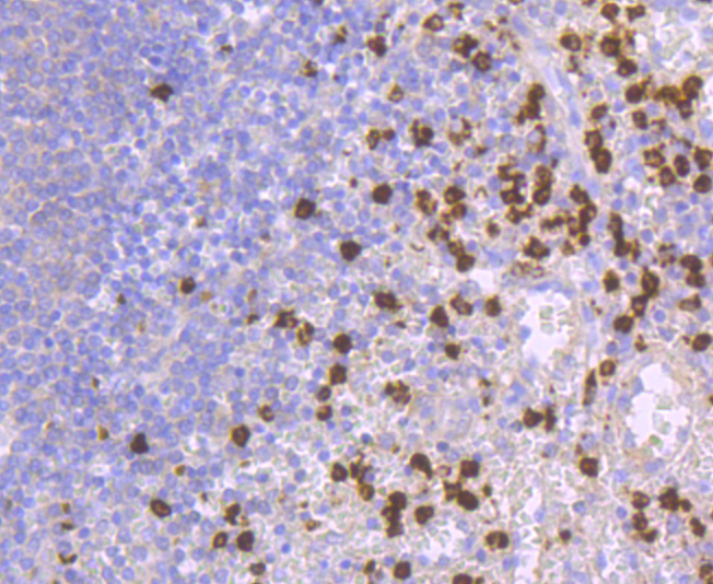 Lipocalin-2 Rabbit mAb