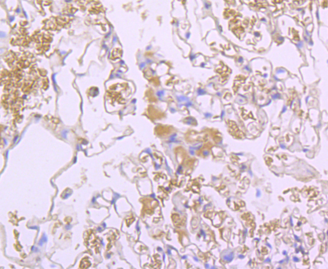 Lipocalin-2 Rabbit mAb