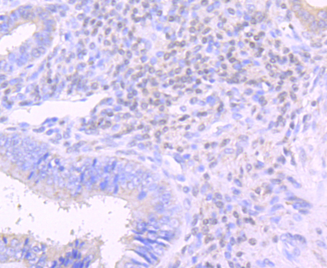 Lipocalin-2 Rabbit mAb