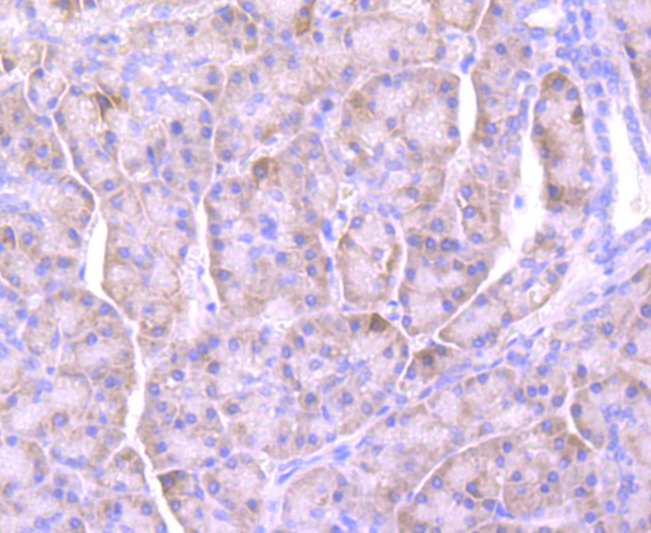 Lipocalin-2 Rabbit mAb