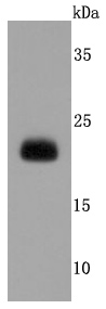 Lipocalin-2 Rabbit mAb