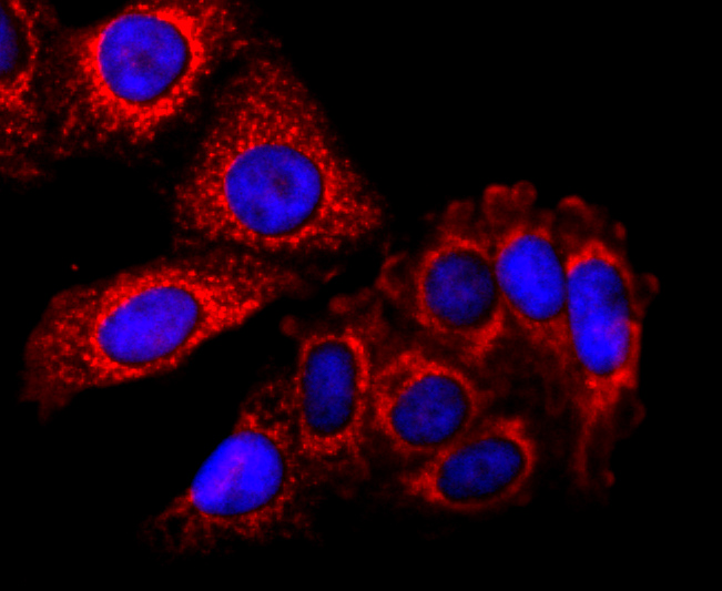 SDHA Rabbit mAb