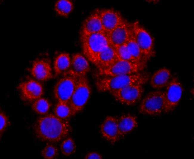 SDHA Rabbit mAb