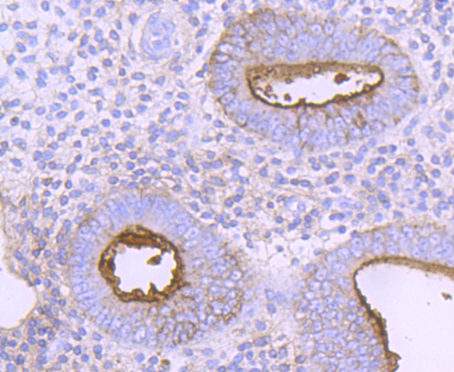 CD73 Rabbit mAb