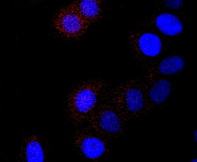 Cathepsin LVKH Rabbit mAb