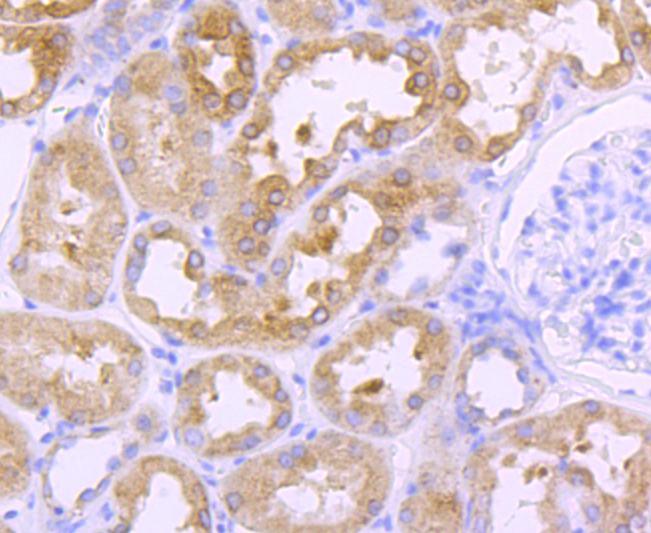 Cathepsin LVKH Rabbit mAb