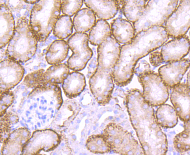 Cathepsin LVKH Rabbit mAb