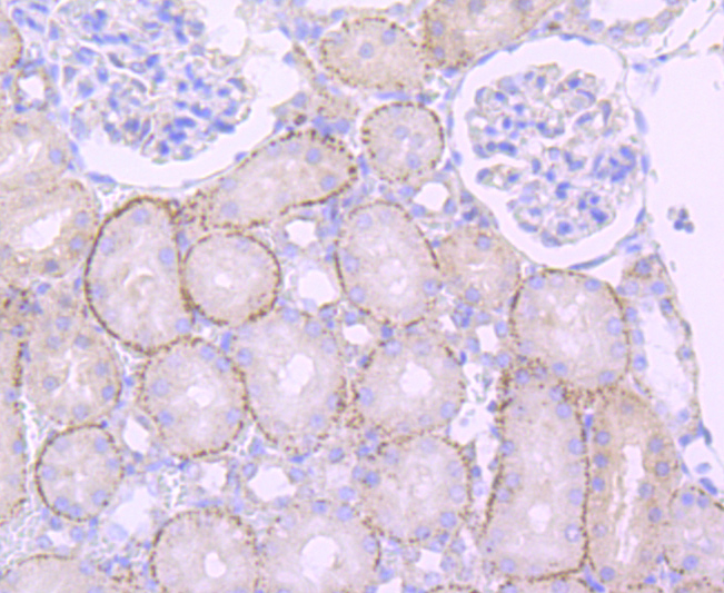 Cathepsin LVKH Rabbit mAb