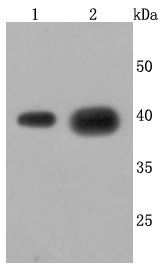 Cathepsin LVKH Rabbit mAb