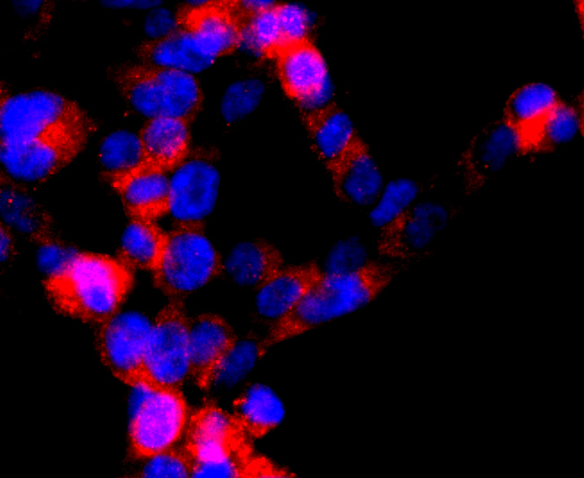 DRD1 Rabbit mAb