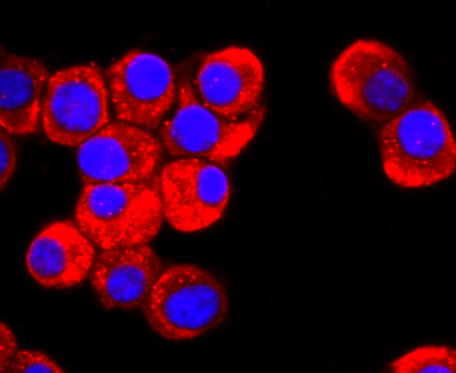 DRD1 Rabbit mAb