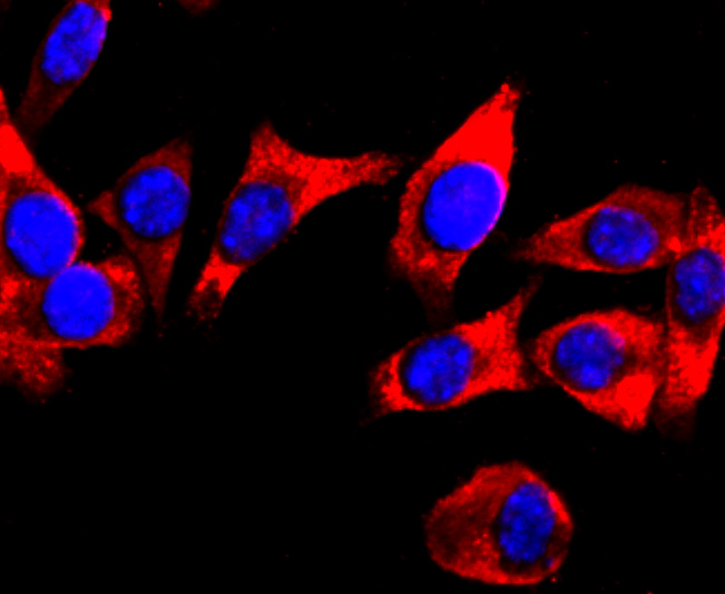 DRD1 Rabbit mAb