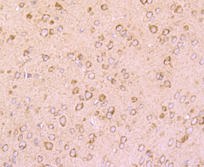 DRD1 Rabbit mAb