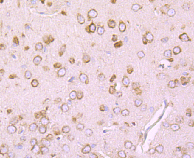 DRD1 Rabbit mAb