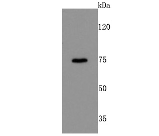 DRD1 Rabbit mAb