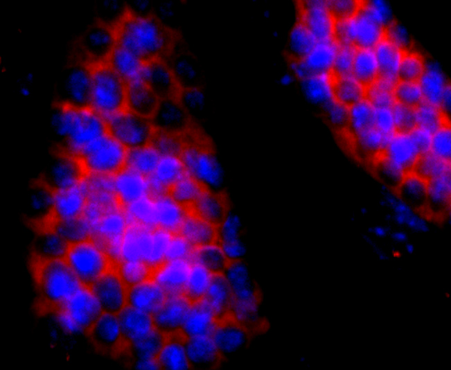 Hemoglobin subunit gamma 1and2 Rabbit mAb