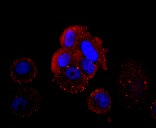 Hemoglobin subunit gamma 1and2 Rabbit mAb