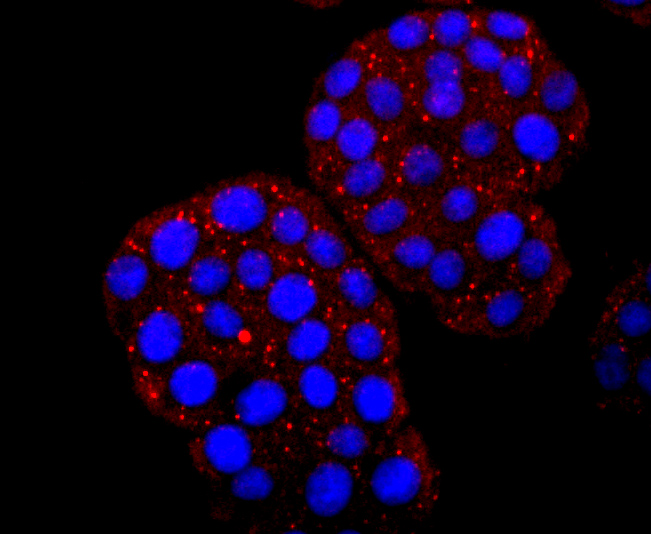 Hemoglobin subunit gamma 1and2 Rabbit mAb