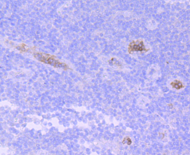 Hemoglobin subunit gamma 1and2 Rabbit mAb