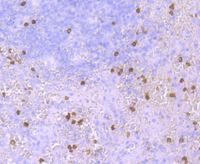 Hemoglobin subunit gamma 1and2 Rabbit mAb