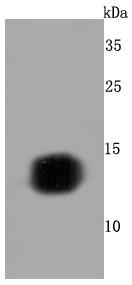 Hemoglobin subunit gamma 1and2 Rabbit mAb