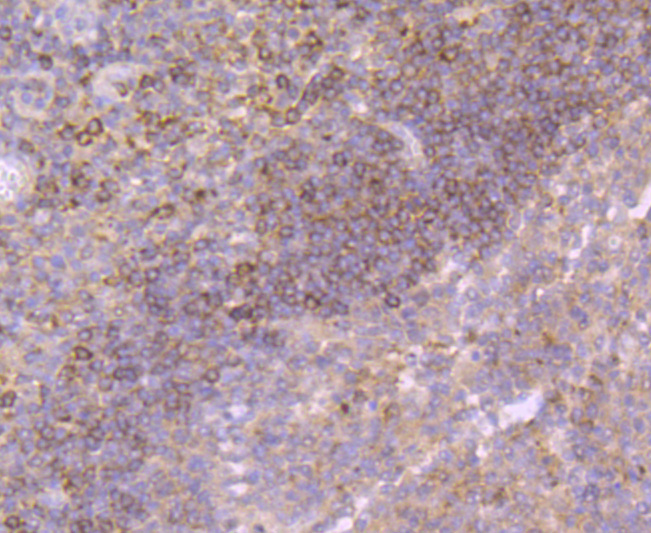 Growth Hormone Rabbit mAb