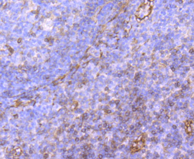 CD62P Rabbit mAb