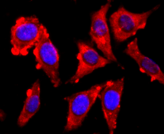 VAMP2 Rabbit mAb