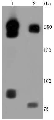 L1CAM Rabbit mAb